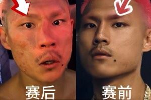 慘遭“整容”！惡鼠遭威姆斯TKO 鼻梁骨被打歪鮮血直流??